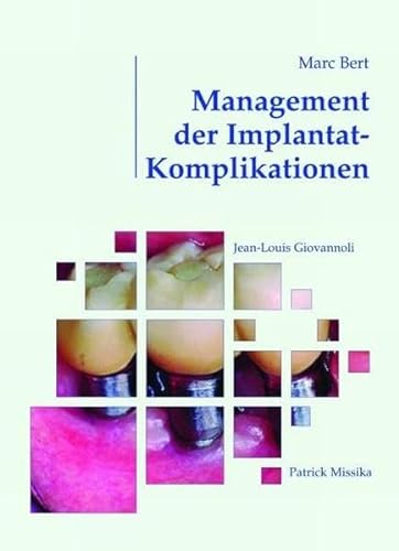 Stock image for Management der Implantat-Komplikationen for sale by Versandantiquariat Ursula Ingenhoff