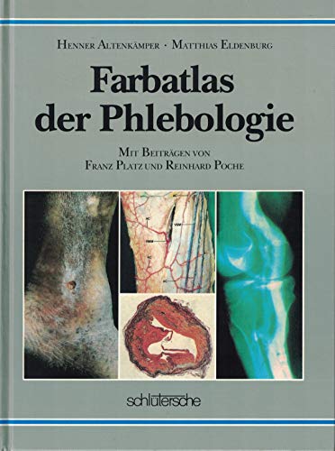 Stock image for Farbatlas der Phlebologie for sale by Versandantiquariat Manuel Weiner