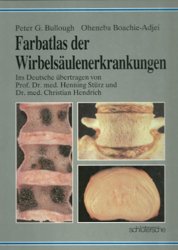 9783877063835: Farbatlas der Wirbelsulenerkrankungen