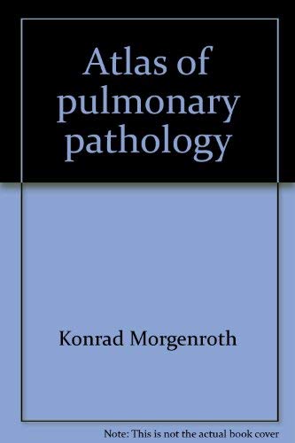 Stock image for Atlas of pulmonary pathology for sale by HPB-Ruby