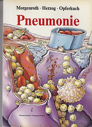 Pneumonie