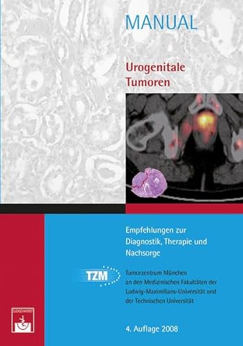 9783886039418: Urogenitale Tumoren: Empfehlungen zur Diagnostik, Therapie und Nachsorge (Manuale Tumorzentrum Mnchen)