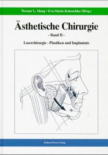 9783887565312: sthetische Chirurgie 2: Laserchirurgie. Plastiken und Implantate