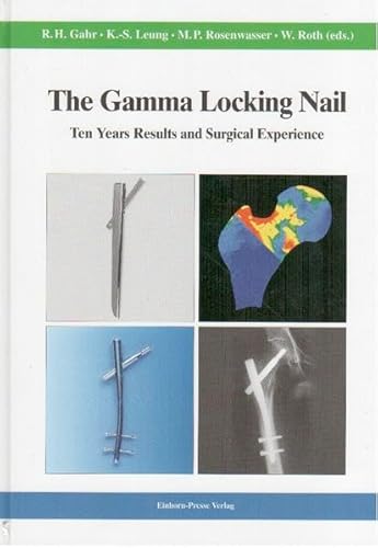 The Gamma Locking Nail: Ten Years Results and Surgical Experience