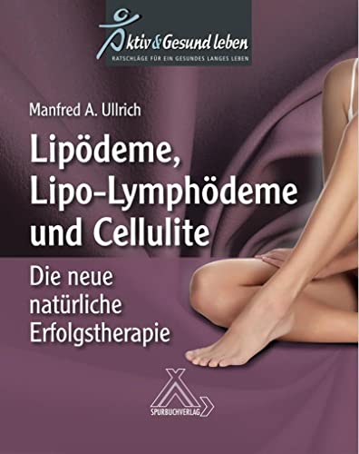 Imagen de archivo de Lipodeme, Lipo-Lymphdeme und Cellulite -Language: german a la venta por GreatBookPrices