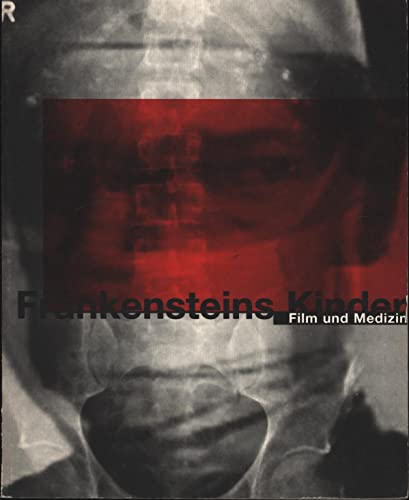 Beispielbild fr Frankensteins Kinder - Film und Medizin zum Verkauf von Antiquariat Hans Wger