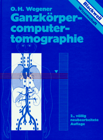 9783894121051: Ganzkrpercomputertomographie