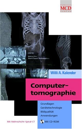 9783895780820: Computertomographie: Grundlagen, Geratetechnolgie Bildqualitat, Anwendungen