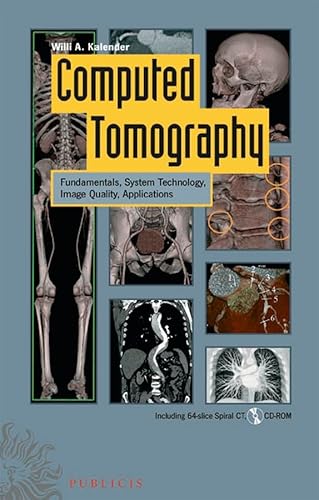 Stock image for Computed Tomography: Fundamentals, System Technology, Image Quality, Applications for sale by Mispah books