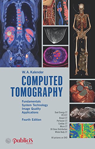9783895784712: Computed Tomography: Fundamentals, System Technology, Image Quality, Applications