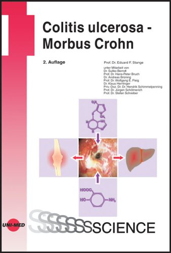 Colitis ulcerosa - Morbus Crohn (9783895998287) by Hofstede, Geert