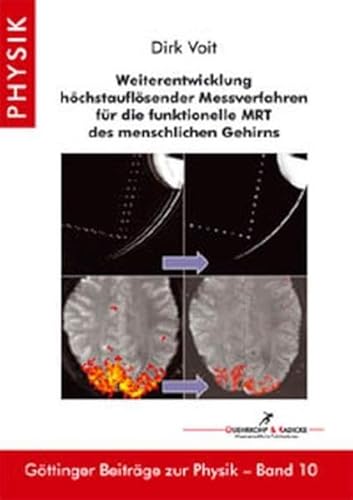 9783897442498: Weiterentwicklung hchstauflsender Messverfahren fr die funktionelle MRT des menschlichen Gehirns