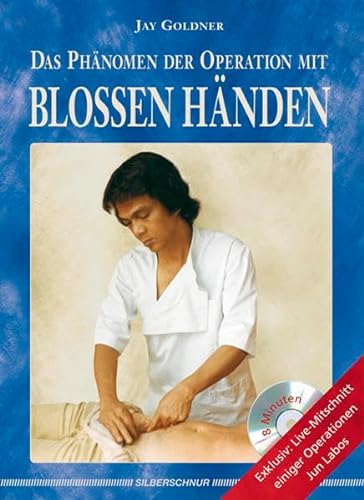 Stock image for Das Phnomen der Operation mit blossen Hnden, m. DVD for sale by medimops