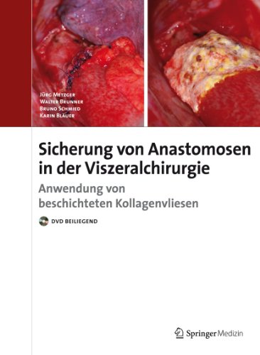 Beispielbild fr Sicherung von Anastomosen in der Viszeralchirurgie: Anwendung von beschichteten Kollagenvliesen zum Verkauf von CSG Onlinebuch GMBH