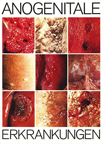 Beispielbild fr Anogenitale Erkrankungen. Regio anogenitalis. Makroskopische Diagnostik zum Verkauf von Versandantiquariat Felix Mcke