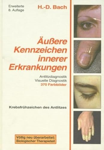 Beispielbild fr Antlitzdiagnostik: uere Kennzeichen innerer Erkrankungen, Bd. 1: Lehrbuch und Farbatlas fr Pathophysiognomie und visuelle Diagnostik zum Verkauf von medimops