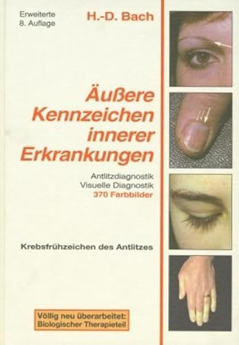 Stock image for Antlitzdiagnostik: uere Kennzeichen innerer Erkrankungen, Bd. 1: Lehrbuch und Farbatlas fr Pathophysiognomie und visuelle Diagnostik for sale by medimops