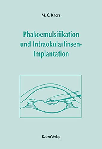 9783922777670: Phakoemulsifikation und Intraokularlinsenimplantation, m. CD-ROM