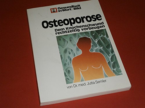 Beispielbild fr Osteoporose. Dem Knochenschwund rechtzeitig vorbeugen zum Verkauf von Versandantiquariat Felix Mcke