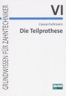 9783929360691: Die Teilprothese: Grundwissen fr Zahntechniker