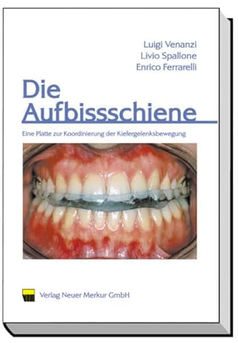 9783929360882: Die Aufbissschiene: Eine Platte zur Koordinierung der Kiefergelenksbewegung