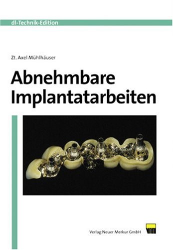 Stock image for Abnehmbare Implantatarbeiten for sale by a2zbooks