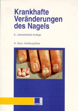 Imagen de archivo de Krankhafte Vernderungen des Nagels a la venta por Altstadt Antiquariat Rapperswil