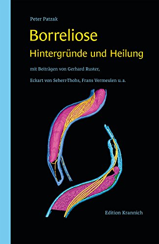 Beispielbild fr Borreliose - Hintergrnde und Heilung zum Verkauf von medimops