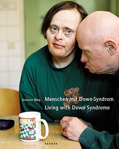 Beispielbild fr Living with Down Syndrome: Photographs by Andreas Reeg zum Verkauf von Magers and Quinn Booksellers