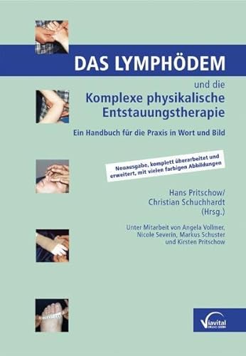 Beispielbild fr Das Lymphdem und die Komplexe Physikalische Entstauungstherapie: Ein Handbuch fr die Praxis in Wort und Bild zum Verkauf von medimops