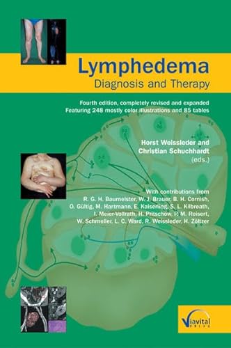 Stock image for Lymphedema-Diagnosis and Therapy: Fourth edition, completely revised and expanded for sale by SecondSale