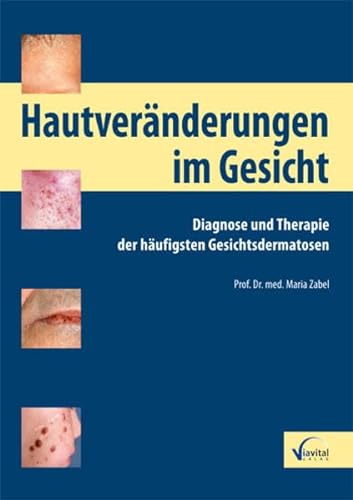 9783934371477: Hautvernderungen im Gesicht: Diagnose und Therapie der hufigsten Gesichtsdermatosen