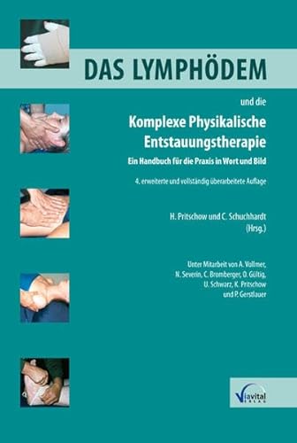 Beispielbild fr Das Lymphdem und die Komplexe Physikalische Entstauungstherapie: Ein Handbuch fr die Praxis in Wort und Bild zum Verkauf von medimops