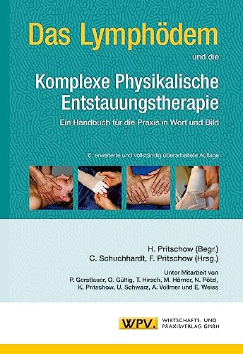 9783934371675: Das Lymphdem und die Komplexe Physikalische Entstauungstherapie: Ein Handbuch fr die Praxis in Wort und Bild