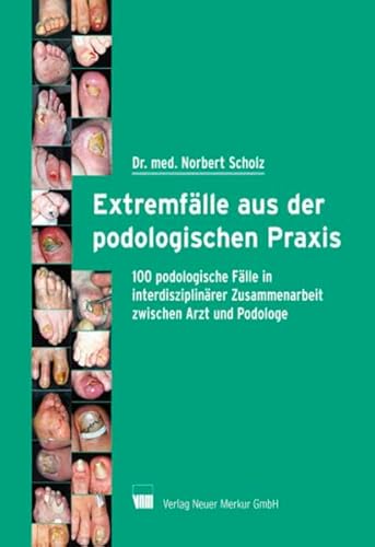 9783937346199: Extremflle aus der podologischen Praxis: 100 podologische Flle in interdisziplinrer Zusammenarbeit zwischen Arzt und Podologe