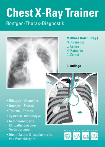 Stock image for Chest-X-Ray-Trainer for sale by medimops