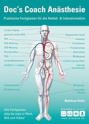 Beispielbild fr Doc`s Coach Ansthesie: Praktische Fertigkeiten fr die Notfall- & Intensivmedizin zum Verkauf von medimops