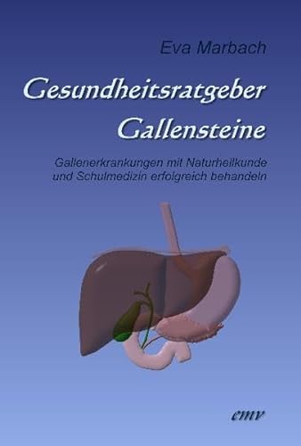9783938764268: Gesundheitsratgeber Gallensteine: Gallenerkrankungen mit Naturheilkunde und Schulmedizin erfolgreich behandeln