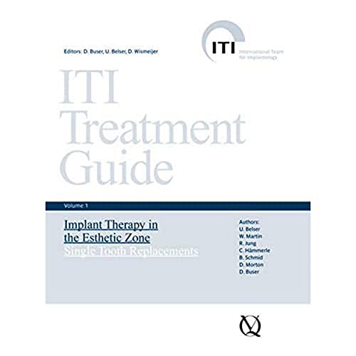 ITI Treatment Guide: Implant Therapy in the Esthetic Zone for Single-tooth Replacements (9783938947104) by Belser, U.; Martin, W.; Jung, R.; Hammerle, C.; Schmid, B.