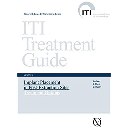 9783938947142: Implant Placement in Post-extraction Sites: Treatment Options (3) (ITI Treatment Guide)