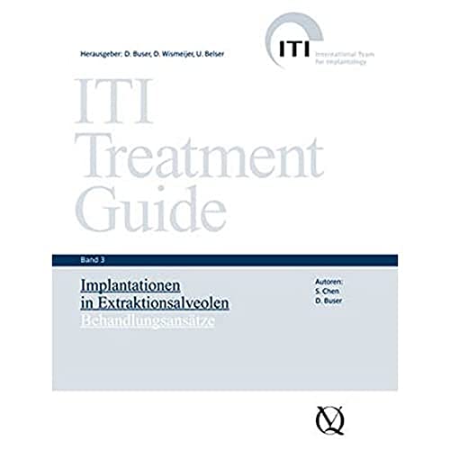 9783938947159: ITI Treatment Guide Band 3: Implantationen in Extraktionsalveolen Behandlungsanstze