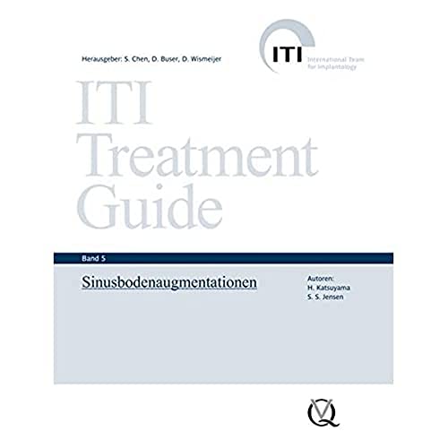 9783938947197: ITI Treatment Guide Band 5: Sinusbodenaugmentationen