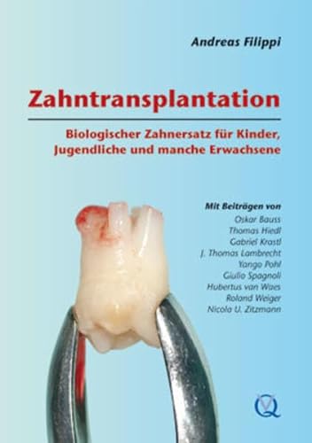 9783938947241: Zahntransplantation: Biologischer Zahnersatz fr Kinder, ...