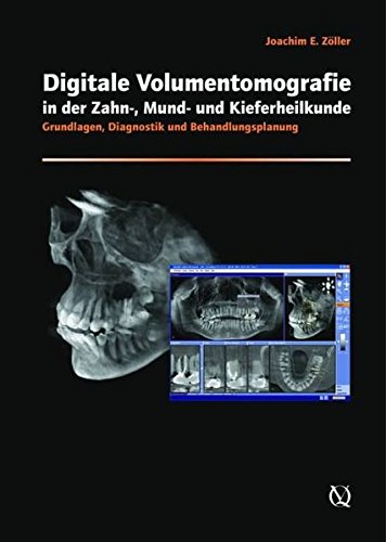 Beispielbild fr Cone-beam Volumetric Imaging in Dental, Oral and Maxillofacial Medicine zum Verkauf von GF Books, Inc.