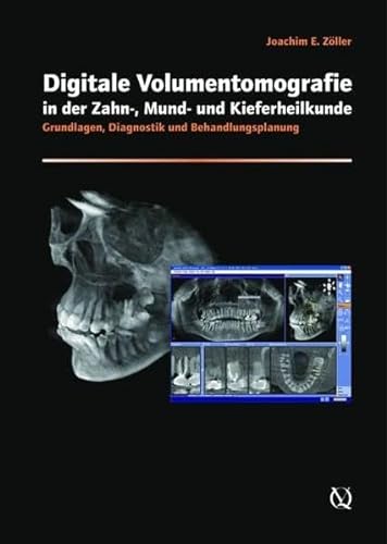 Cone-beam Volumetric Imaging in Dental, Oral and Maxillofacial Medicine (9783938947463) by Zoller, Joachim; Neugebauer, Jorg