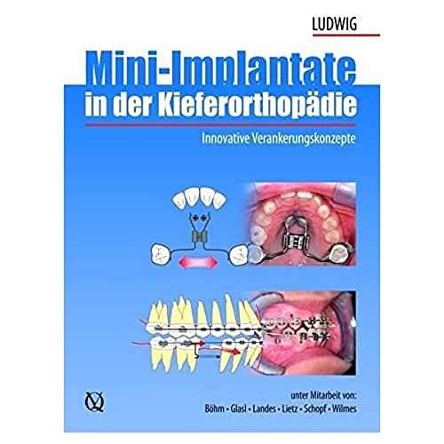 9783938947470: Mini-implants in Orthodontic: Innovative Anchorage Concepts