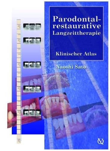 Imagen de archivo de Parodontal-restaurative Langzeittherapie: Klinischer Atlas a la venta por medimops