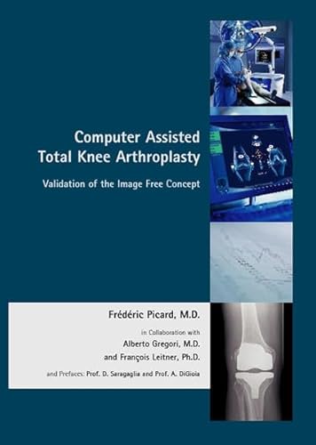 9783939533153: Computer Assisted Orthopaedics: The Image Free Concept in Total Knee Arthroplasty (Validation of the Image Free Concept)