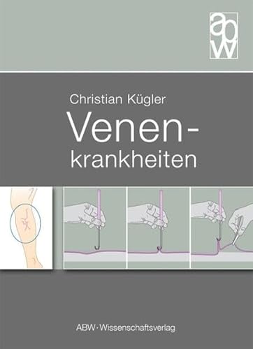 Venenkrankheiten