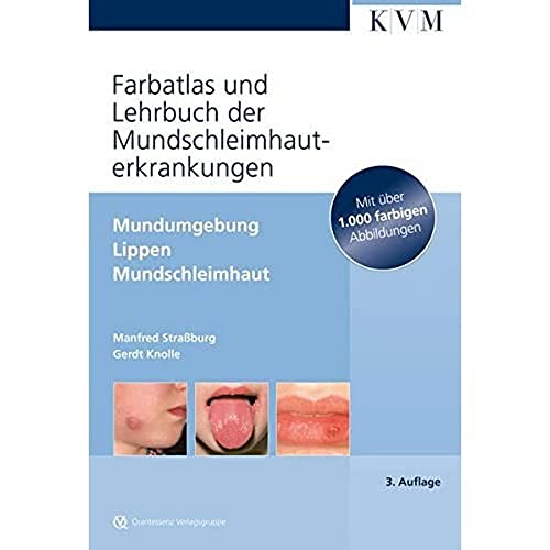 9783940698759: Farbatlas und Lehrbuch der Mundschleimhauterkrankungen: Mundumgebung,Lippen, Mundschleimhaut